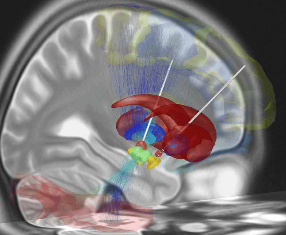 Ressonância Magnética de Cérebro Humano mostrando partes internas nas cores vermelha, azul, verde e amarelo.