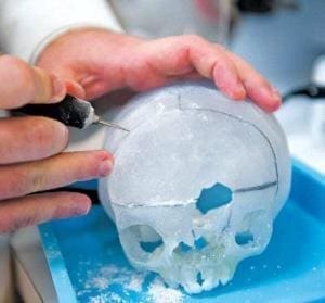 Impressão 3D de biomodelos salvando vidas humanas 2