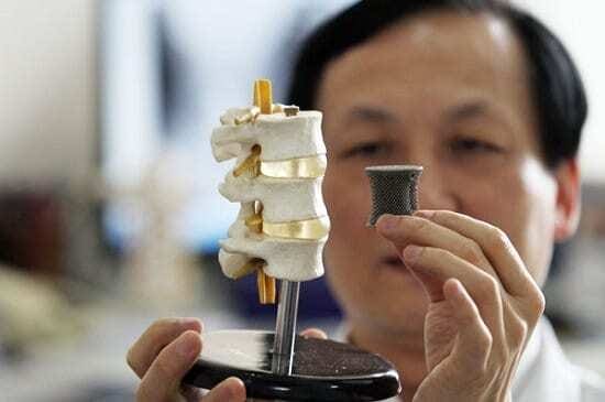 Médico segurando molde de vértebras da coluna com um pino impresso em impressora 3D ao lado, dando ideia de prótese.